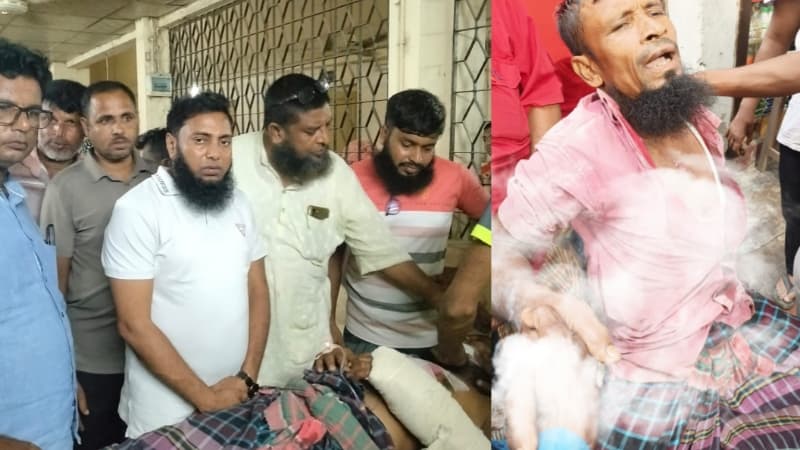 বেনাপোল বন্দরে ভারী যন্ত্রাংশ বুকে পড়ে আশঙ্কাজনক অবস্থায় শ্রমিক