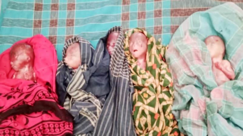 শার্শায় পাঁচ সন্তানের জন্ম দিয়েছেন এক গৃহবধু, জন্মের পরই পাঁচজনের মৃত্যু